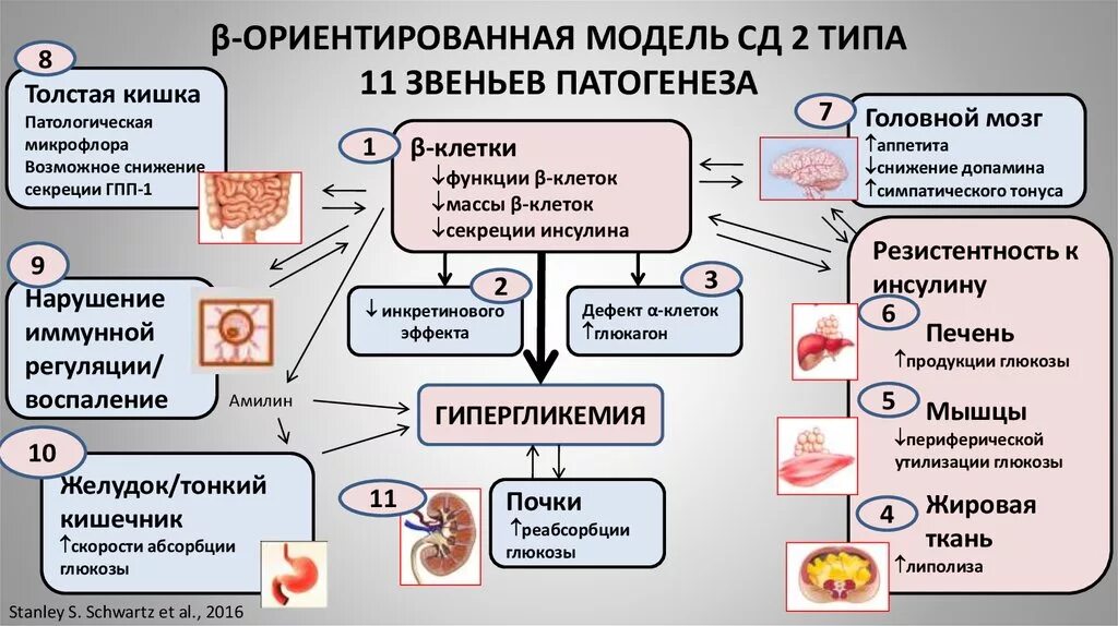 Диабет с множественными осложнениями. Механизм развития сахарного диабета 2 типа схема. Механизм развития СД 2 типа. Механизм развития сахарного диабета 1 типа схема. Сахарный диабет 2 механизм развития.