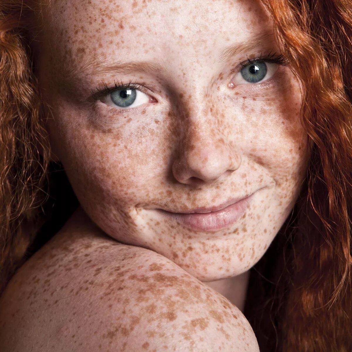 Freckles перевод. Пигментация ксеродерма. Веснушки эфелиды.