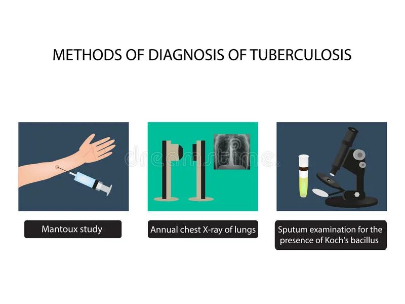 Diagnostic methods