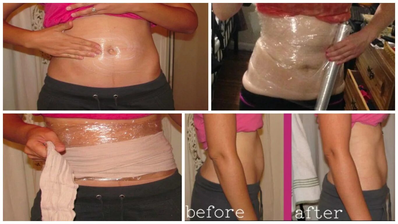 Обертывание скрабирование. Водорослевое обертывание. Антицеллюлитное обертывание тела. Холодное обертывание для похудения. Бандажное антицеллюлитное обертывание.