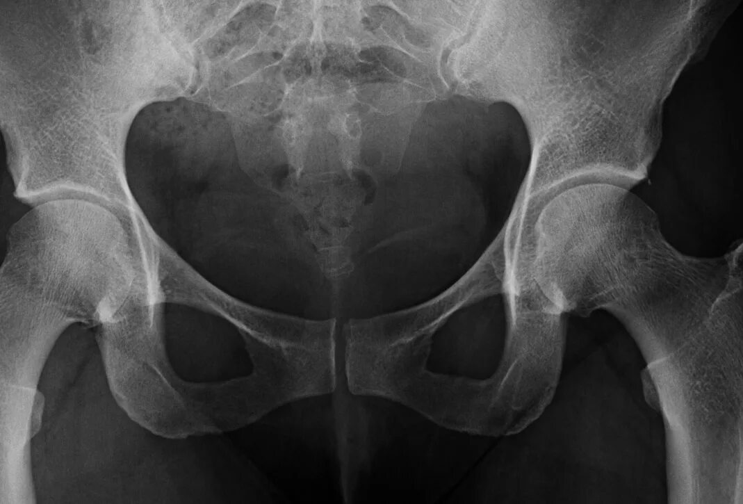 Source x rays