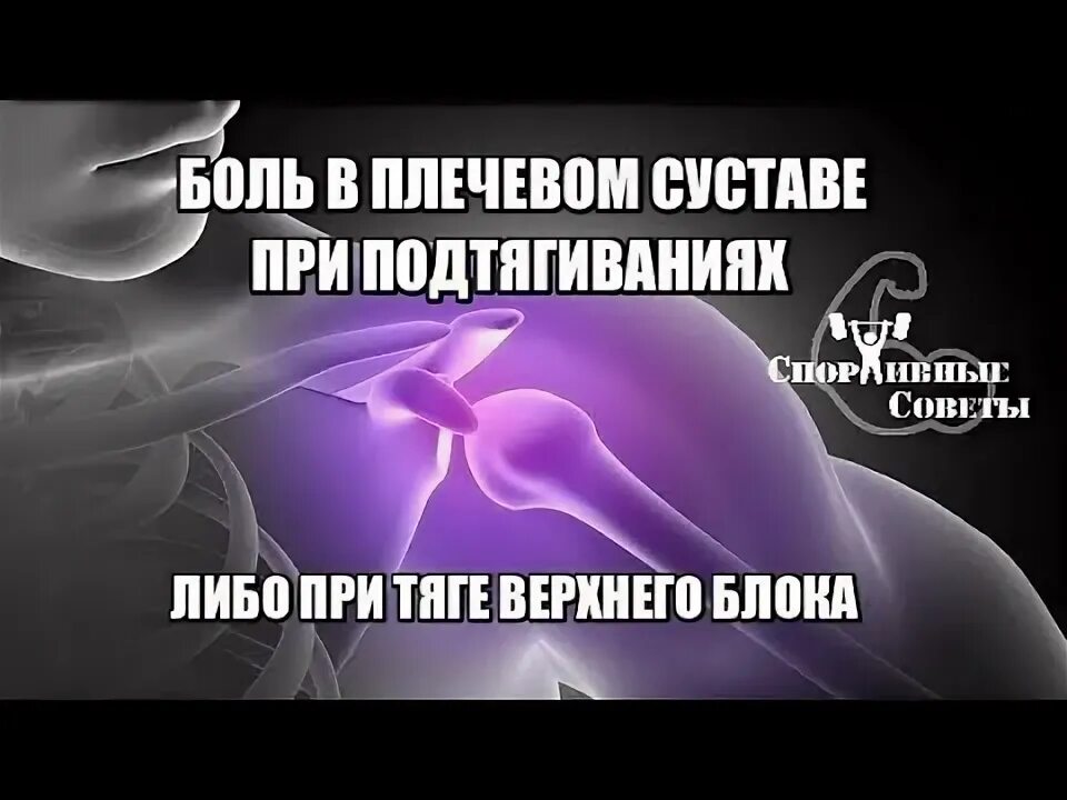Как снять боль в плечевом суставе левой Что означают наклейки у волейболисток на плече (синие, черные, красные)