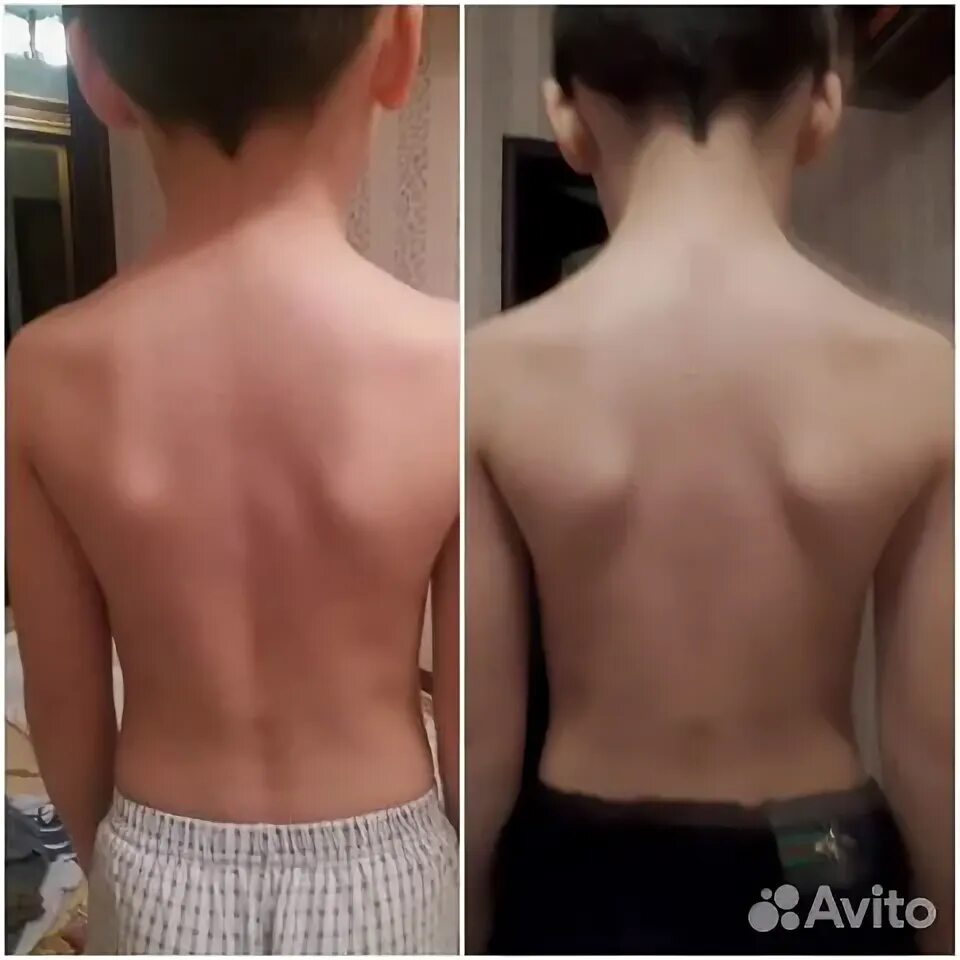 Зуля махачкала. Массаж каспийск. Реклама биоэнергетического массажа. Бионергетическиймассаж. Массаж каспийск и махачкала.