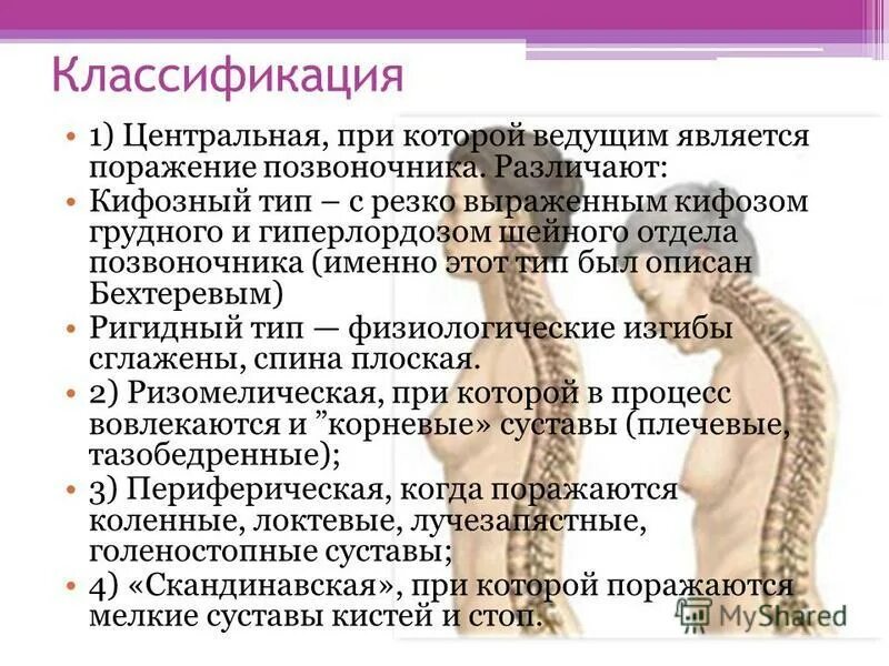 Болезнь Бехтерева патогенез. Болезнь Бехтерева шейного отдела. Анкилозирующий спондилоартрит патогенез.