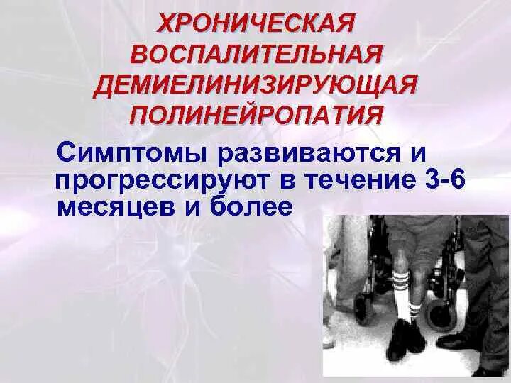 Хроническая демиелинизирующая полинейропатия. Демиелинизирующая полинейропатия. Хроническая воспалительная демиелинизирующая полинейропатия. Симптомы демиелинизирующей полинейропатии. Острая воспалительная демиелинизирующая полиневропатия.