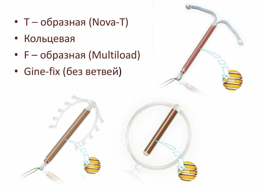 Нова т отзывы. T – образная (Nova-t).