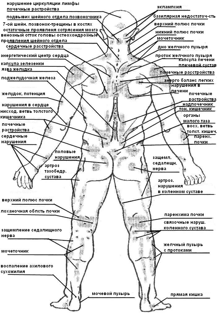 Какие органы у человека с левой. Болевые точки у человека сзади. Анатомия человека внутренние органы сзади со спины. Огулов зоны на теле человека проекционные. Огулов проекционные зоны внутренних органов на теле человека.