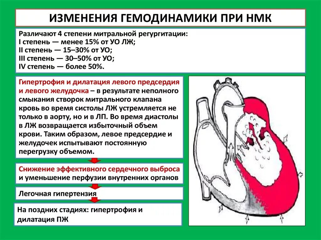 Сердечная недостаточность митрального клапана. Расстройства гемодинамики при недостаточности митрального клапана. Митральный стеноз гемодинамика схема. Недостаточность митрального клапана гемодинамика. Изменение гемодинамики при недостаточности митрального клапана.