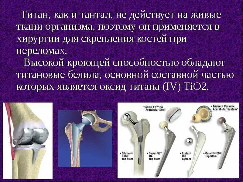 Применение титана. Протезы из титана. Применение титана в медицине. Титановые сплавы в медицине. Применение металлов в медицине