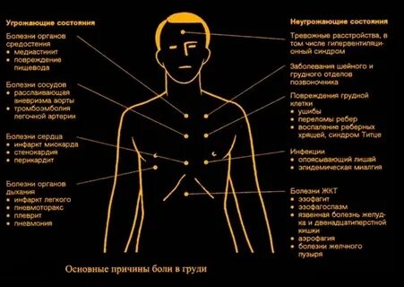 Почему левая сверху