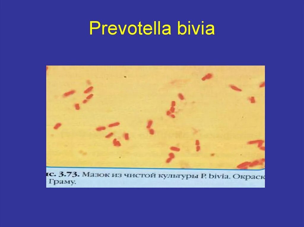 Prevotella bivia у женщин