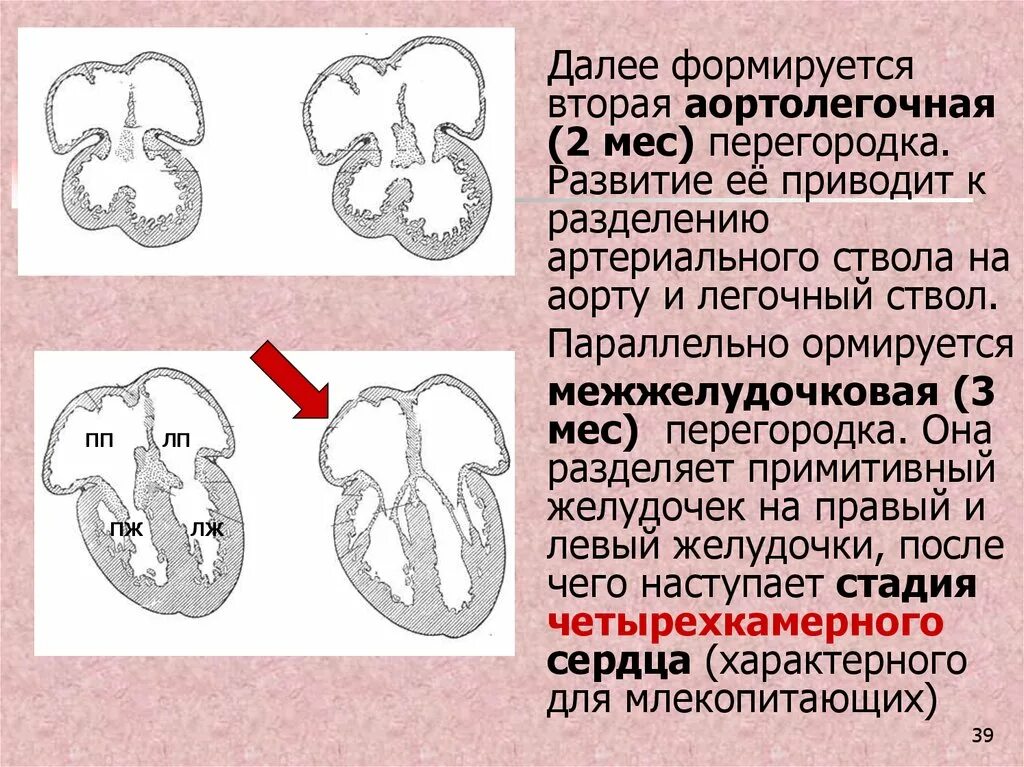 Дефект аортолегочной перегородки тест. Дефект аортолегочной перегородки. дефект аортолегочной перегородки типы. классификация дефекта аортолегочной перегородки. дефект аортолегочной перегородки на эхокг.