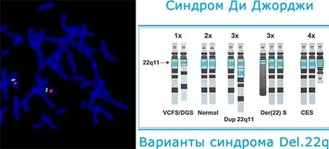 Синдром делеции