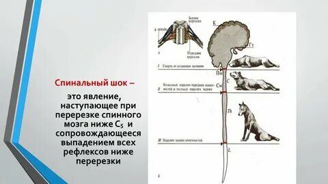 Перерезки спинного мозга