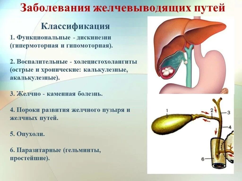 Дискинезия желчевыводящих путей симптомы форум. Классификация болезней желчевыводящих путей. болезни желчных путей классификация. поражения желчного пузыря желчевыводящих путей у детей. печень желчный пузырь желчные протоки классификация.