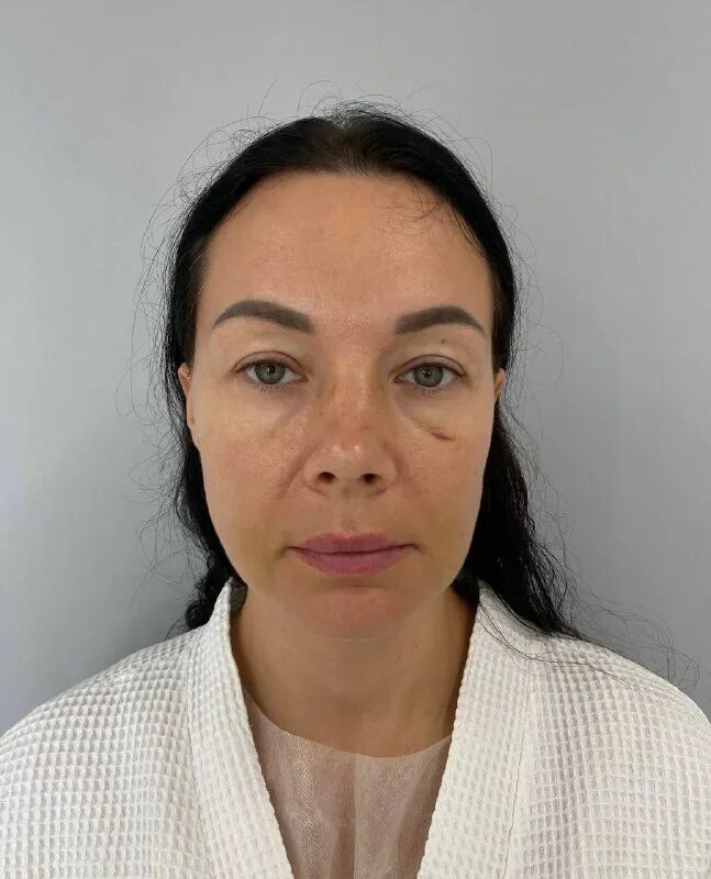 пациентка 38 лет