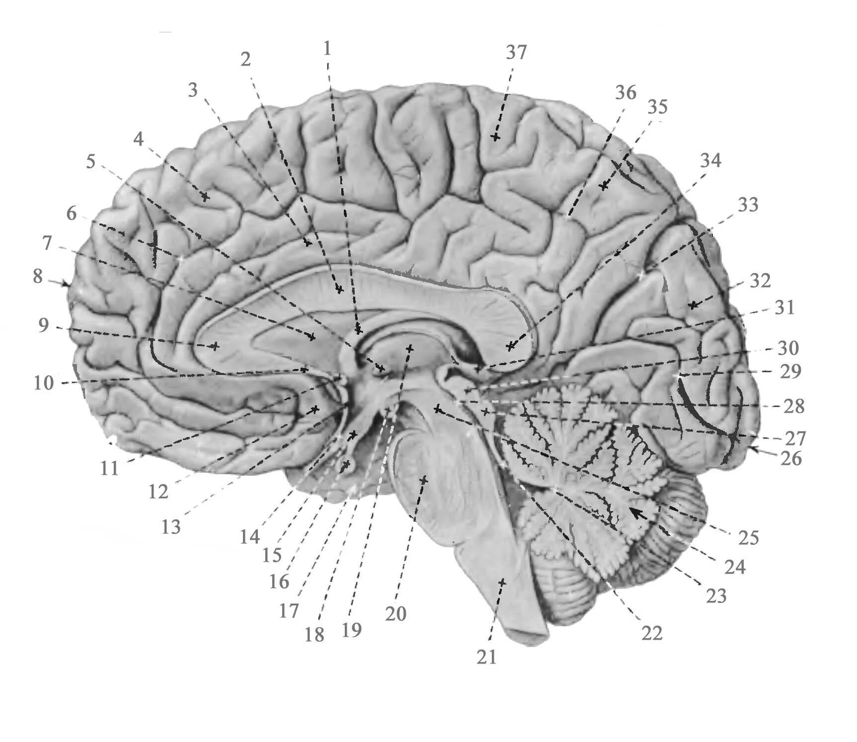 Сагиттальный разрез мозга анатомия. Срединный Сагиттальный срез головного мозга. Медиальный разрез головного мозга. Медиальная поверхность головного мозга Сагиттальный разрез мозга. Складчатая поверхность головного мозга