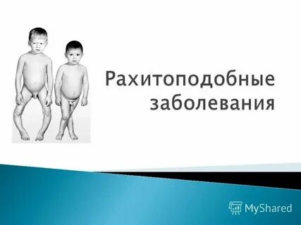 Рахитоподобные заболевания