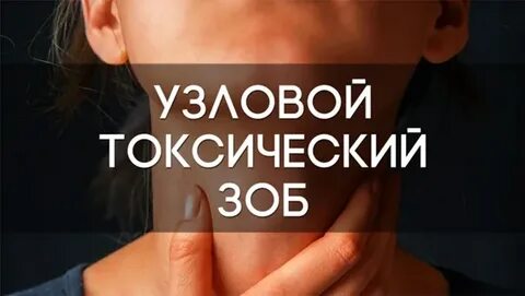 Многоузловой зоб у женщин