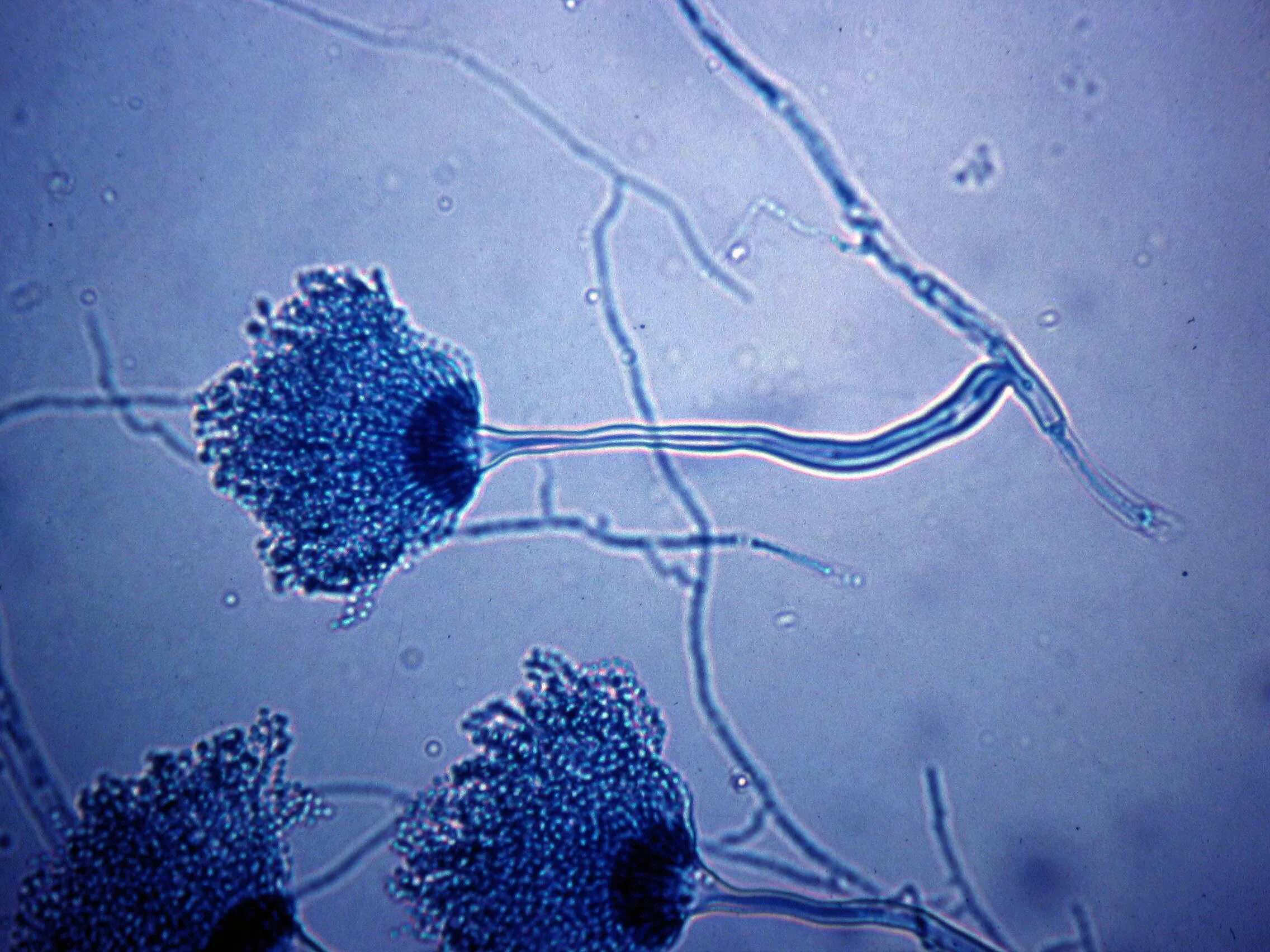 Патогенные грибы споры. Плесневые грибы аспергилл. Грибы Aspergillus flavus. Aspergillus fumigatus - гриб. Микроскопия аспергилл.