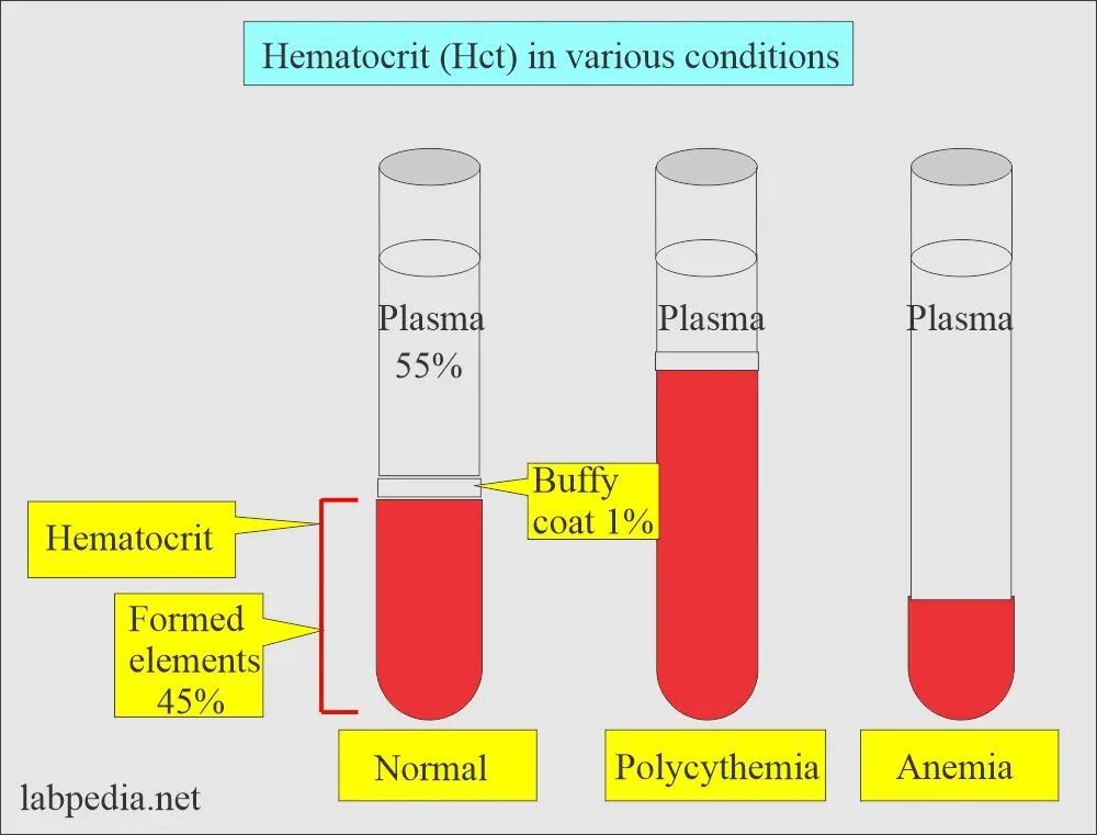 Гематокрит (HCT). Гематокрит что это такое в крови. Гематокрит капиллярной крови. Гематокрит норма.
