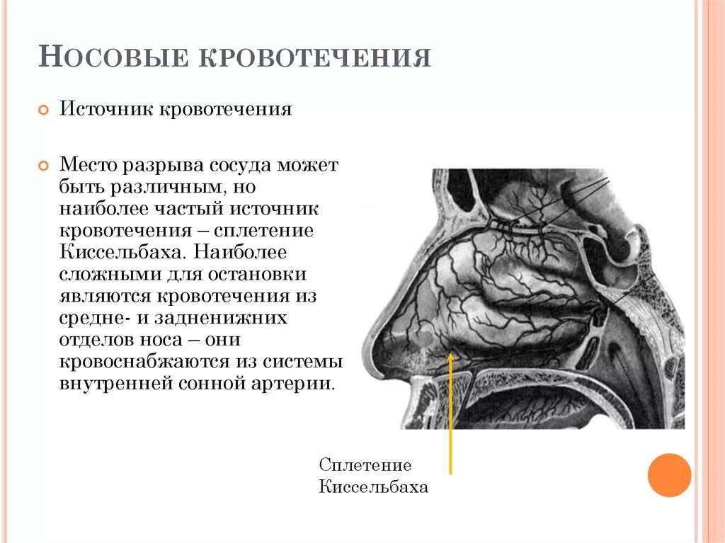 Причины частых носовых кровотечений. Наиболее частый источник носовых кровотечений. Источники носового кровотечения. Носовые кровотечения локализация.