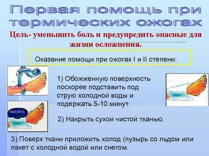 Первая помощь при ожогах 8 класс биология