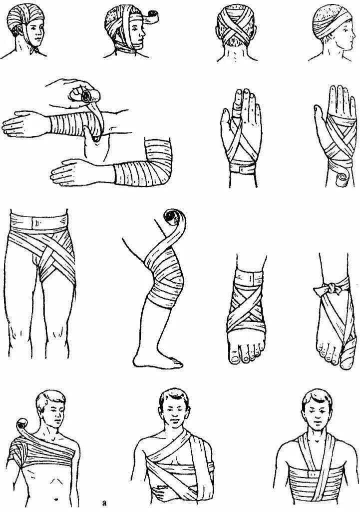 Повязка на руку схема. Десмургия перевязка руки. Перебинтовать плечо эластичным бинтом. Дисмургия при перелом е руки. Бинтование руки при переломе.