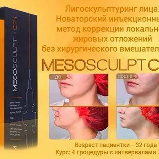 Mesosculpt