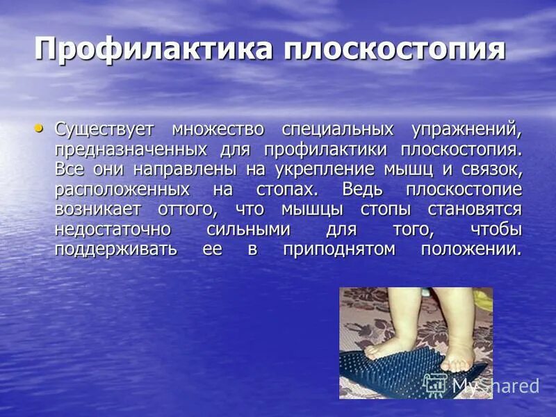 Плоскостопие может быть предотвращено. Профилактика плоскостопия. презентация на тему плоскостопие. профилактика нарушения плоскостопия. меры профилактики плоскостопия.