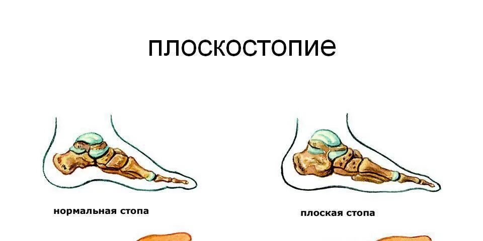 Горят стопы ног причины.