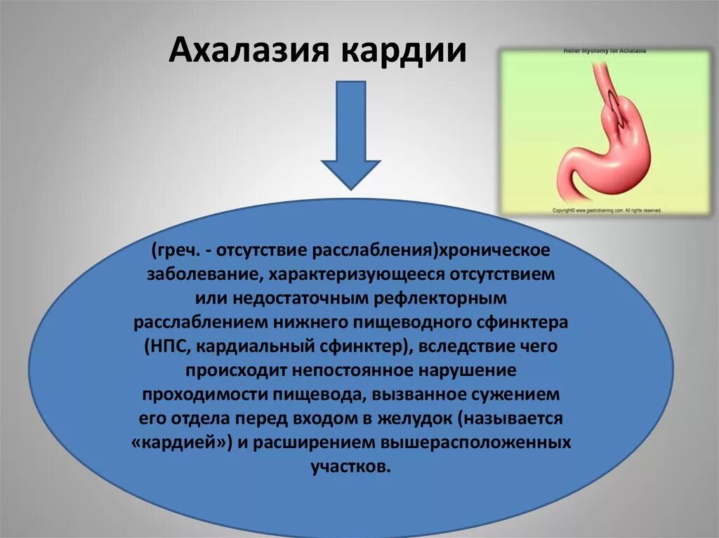 Признаки кардии желудка. Ахалазия кардии протокол. Заключение ФГДС недостаточность кардии.