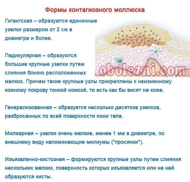 Слизистые покровы или гладкая поверхность мелкие размеры. Моллюск на теле: контагиозный моллюск. Контагиозный моллюск Комаровский. Милиарный контагиозный моллюск.