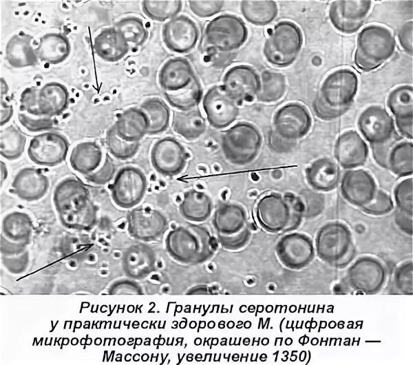 Гранулы тромбоцитов содержат