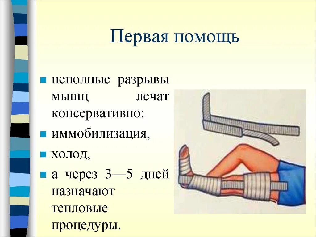 Лечение частичного разрыва мышц. Разрыв мышц оказание помощи. Иммобилизация при травмах опорно двигательного аппарата. Разрыв мышц первая помощь. Транспортная иммобилизация конечностей.