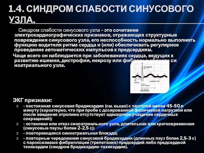 Дисфункция синусового узла что это. Синдром слабого синусового узла ЭКГ. Синдром слабости синоатриального узла ЭКГ. Атропиновая проба при синдроме слабости синусового узла. ЭКГ критерии дисфункции синусового узла.