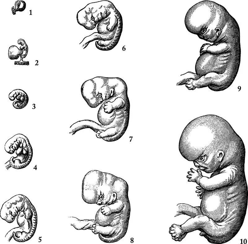Наличие хвоста у зародыша человека на ранней. Зародыш человека на разных стадиях развития. Эмбриональное развитие. Зародыш человека 2 месяца.
