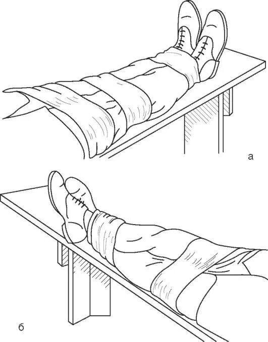 Перелом голени транспортировка. Иммобилизация при переломе нижней конечности. Иммобилизация конечности при переломе голени. Транспортная иммобилизация при переломе нижней конечности. Перелом голени транспортная иммобилизация.