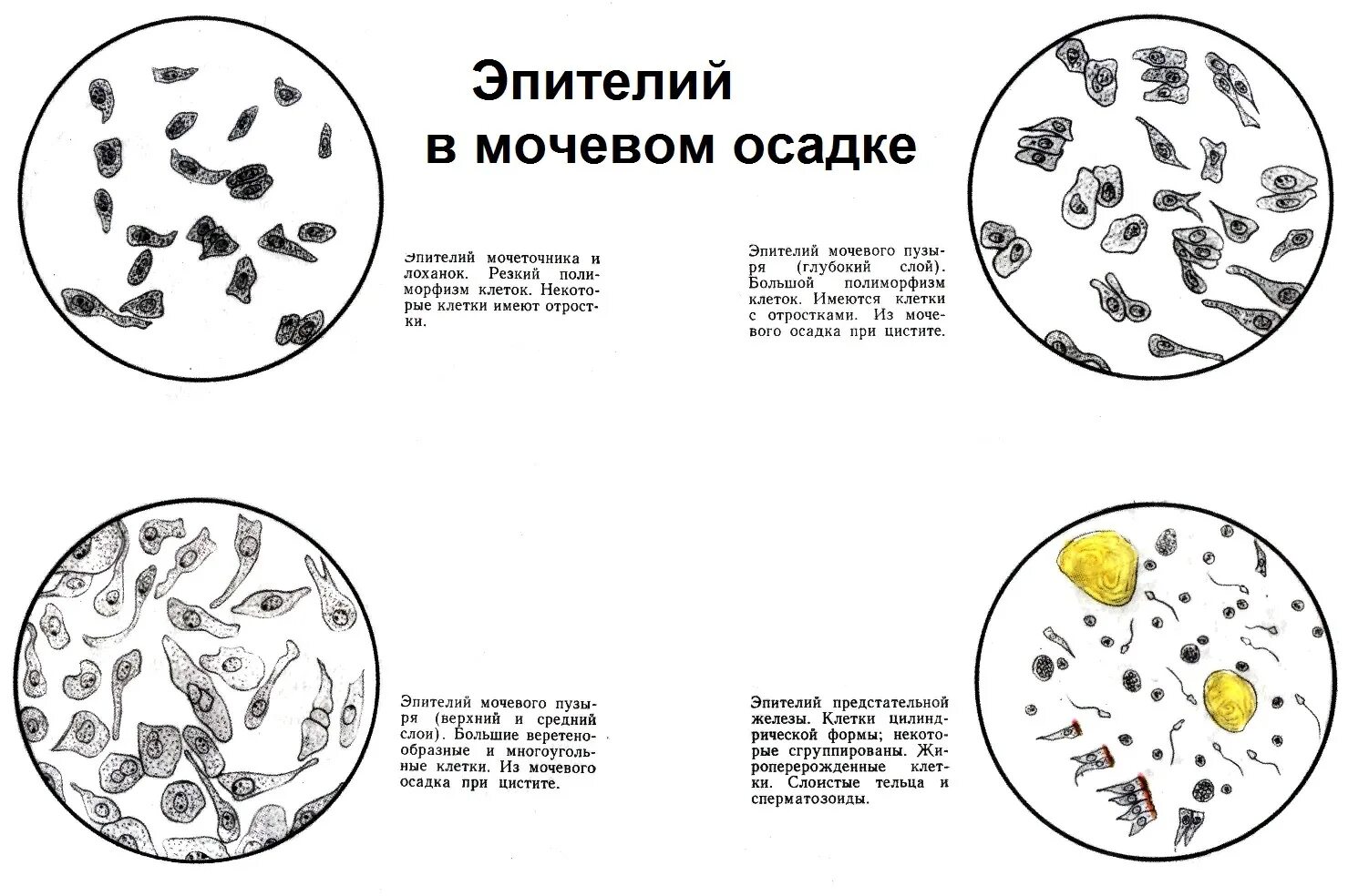 Микроскопический осадок мочи