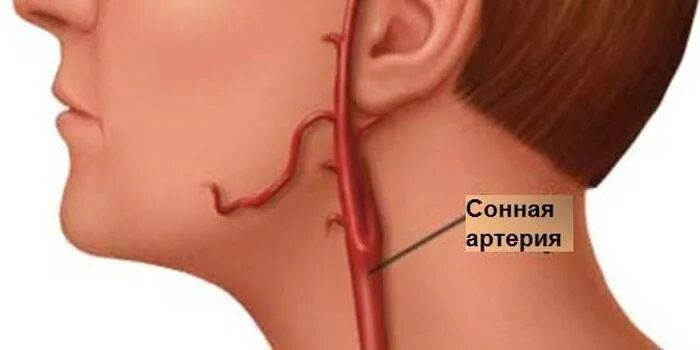 Сонные артерии на шее человека фото