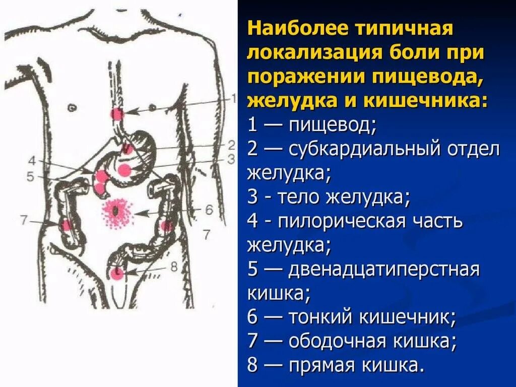 Болезненный кишечник. Локализация боли при гастрите. Локализация боли в животе. Локализация боли при ЖКТ. Локакализация боли при гастрите.