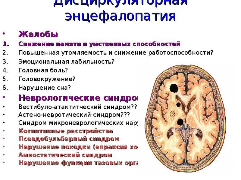 Энцефалопатия неуточненная у ребенка что это. Дисциркуляторная энцефалопатия неврология. Энцефалопатия головного мозга что это такое. Энцефалопатия основные симптомы.