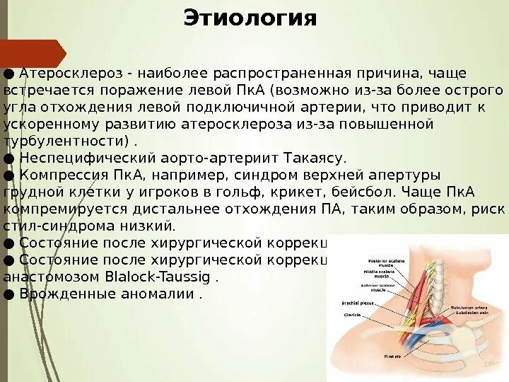 Стил синдром. Синдром подключичной артерии. Синдром позвоночно-подключичного обкрадывания. Синдром подключичного обкрадывания симптомы. Синдром обкрадывания подключичной артерии.