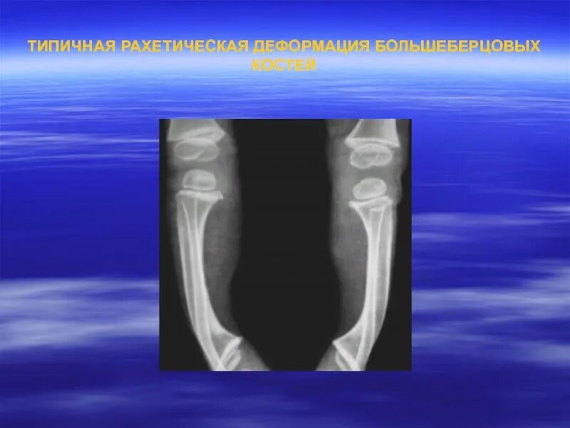 Foot X Ray Изображения - скачать бесплатно на Freepik