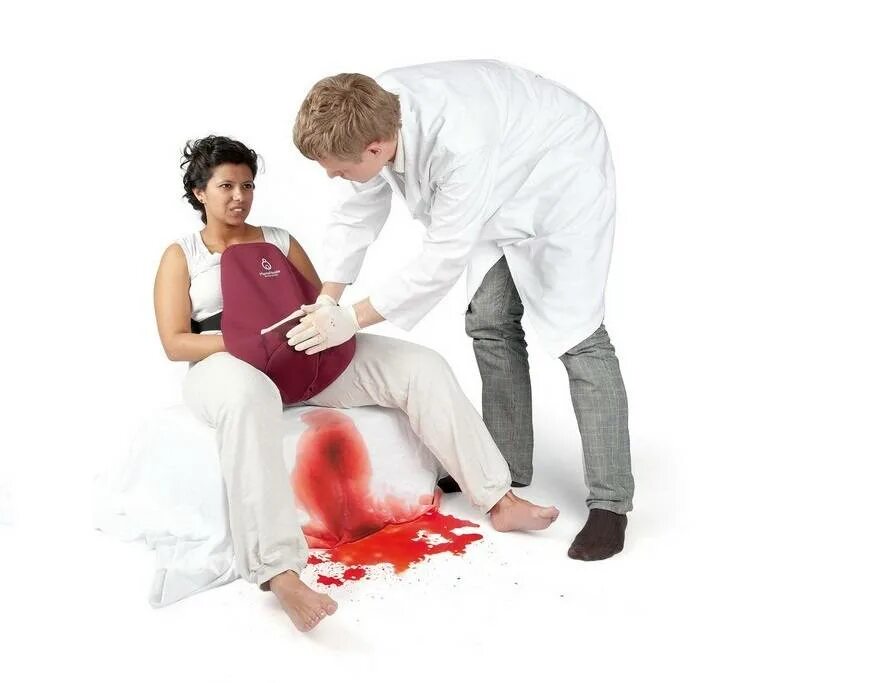 Мужчина во время родов. Послеродовое кровотечение. Послеродовые кровотечени. Акушерские послеродовые кровотечения.
