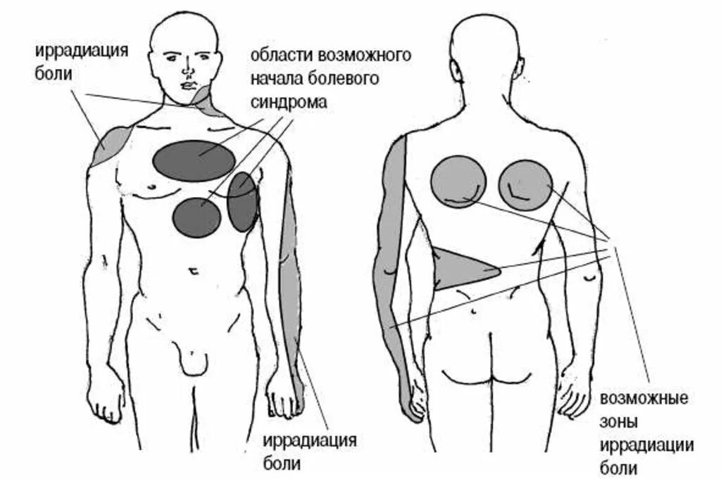 Иррадиация сердца. Локализация области сердца. Локализация боли в груди.