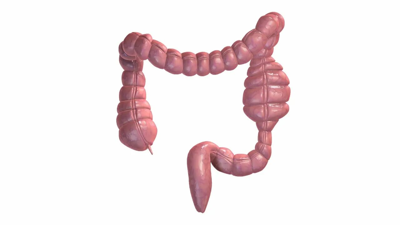 Толстая кишка запор. Толстый кишечник сужение.