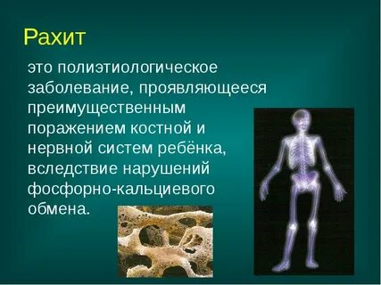 Заболевание костной системы у детей