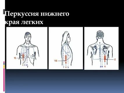 Нижний легкая