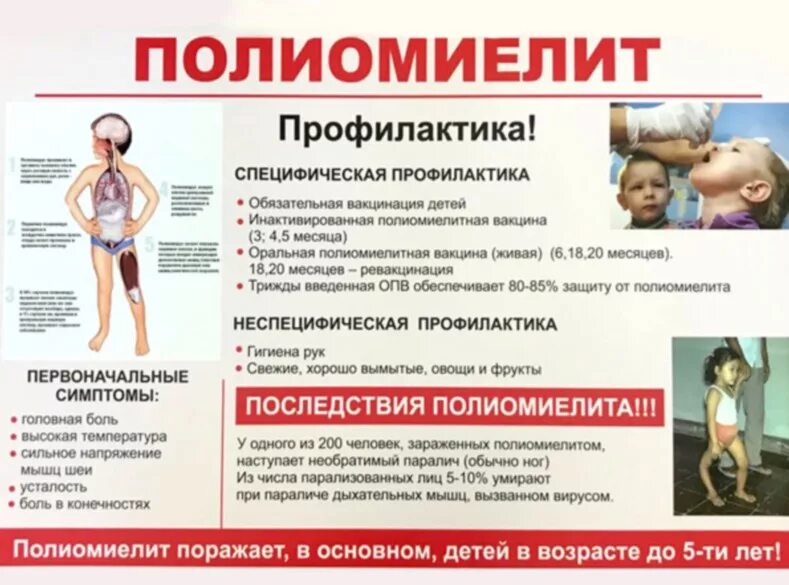 Неспецифическая профилактика полиомиелита. Профилактика болезни полиомиелит. Специфические симптомы полиомиелита. Полиомиелит специфическая профилактика и вакцинация
